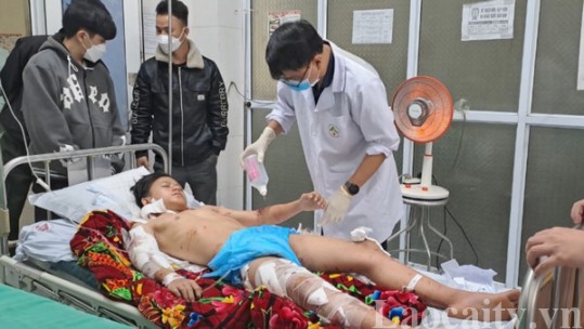 Lào Cai: Một sinh viên bị chó cắn gây thương tích nặng