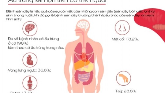 Nhận diện về bệnh sán dây, ấu trùng sán lợn