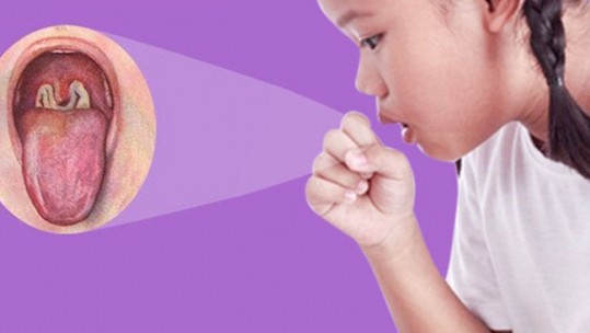 Bệnh bạch hầu - Những điều cần lưu ý